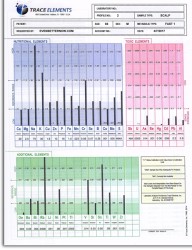 Hair Analysis (TEI Profile 2) - Test 36 Minerals & Toxic Metals